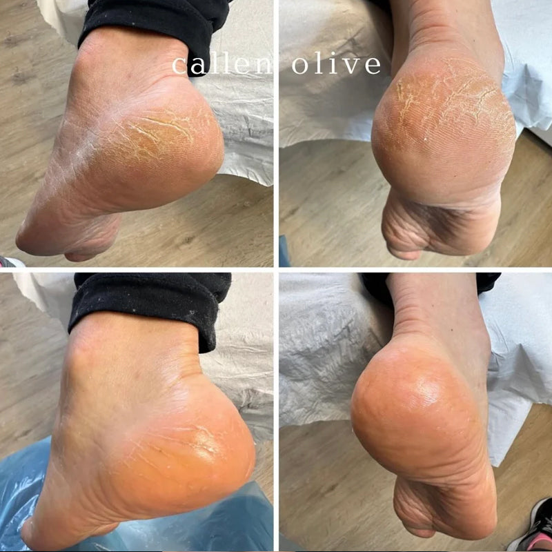 Callen Olive Foot Sole & Heel Saviour Balm 80ml